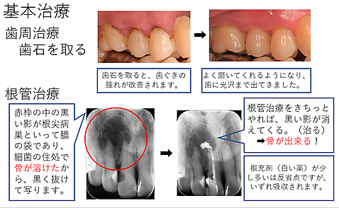 基本治療