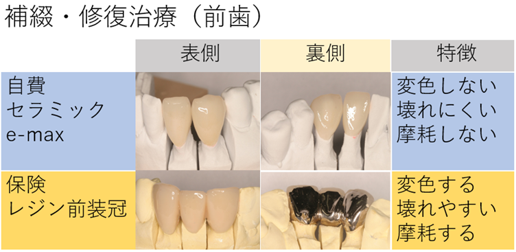 修復治療