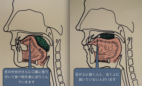 舌背の位置