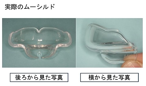 実際のムーシルド