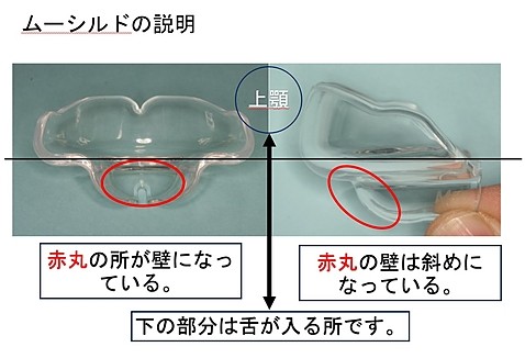 ムーシルドの説明