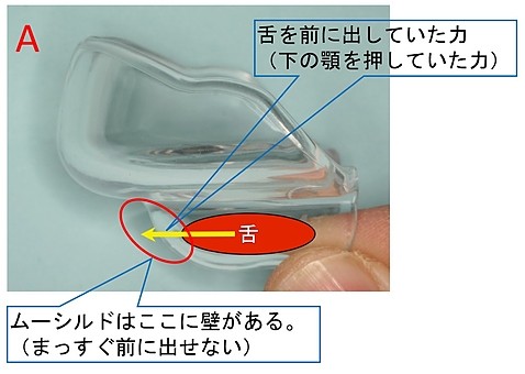 ムー治すA