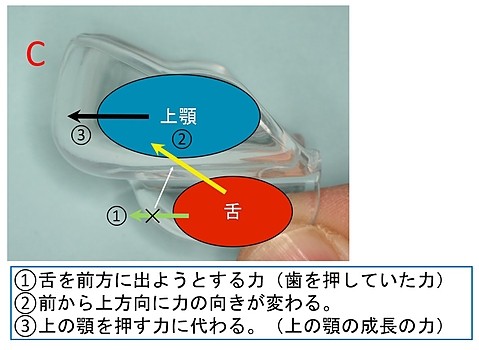 ムー治すC