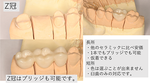 Z冠